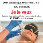 Epilation laser barbe définition, pommettes et collier