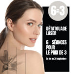 Détatouage laser XL ZONE