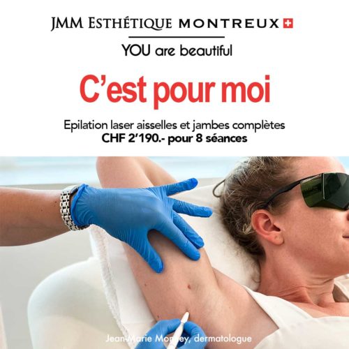 Epilation Laser AISSELLES JAMBES COMPLETES