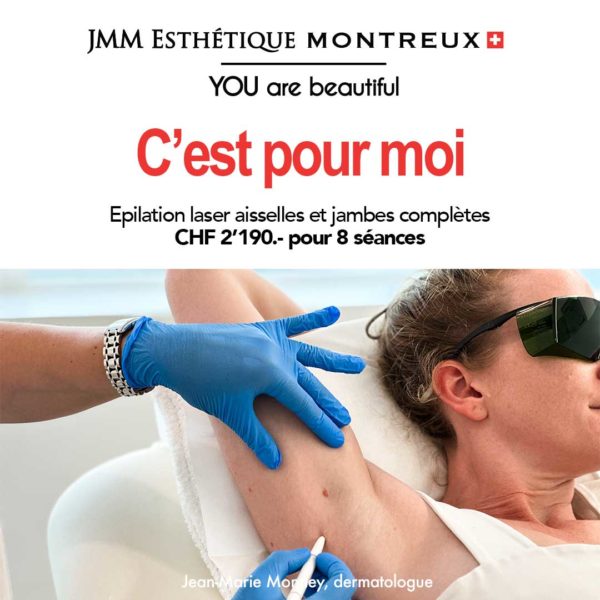 Epilation Laser AISSELLES JAMBES COMPLETES