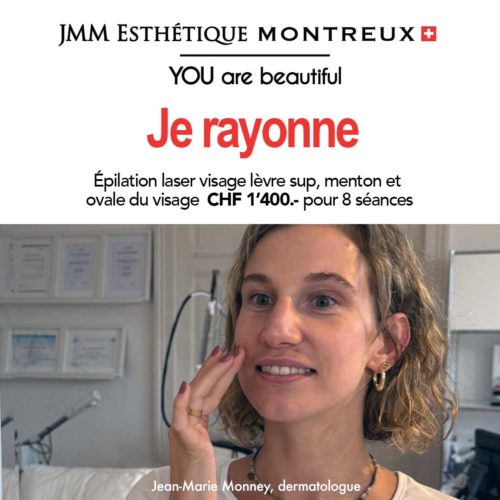 Epilation Laser VISAGE